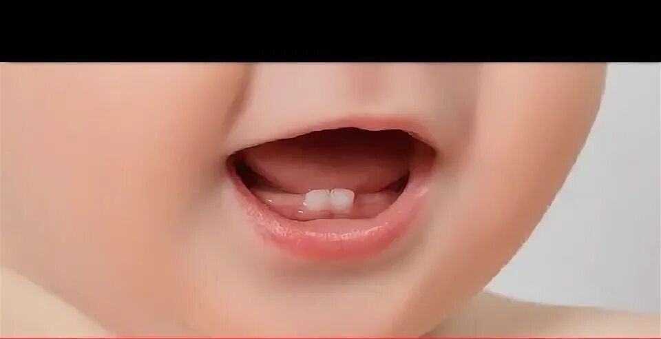 Tish chiqayotganda bolaga qanday yordam berish mumkin?